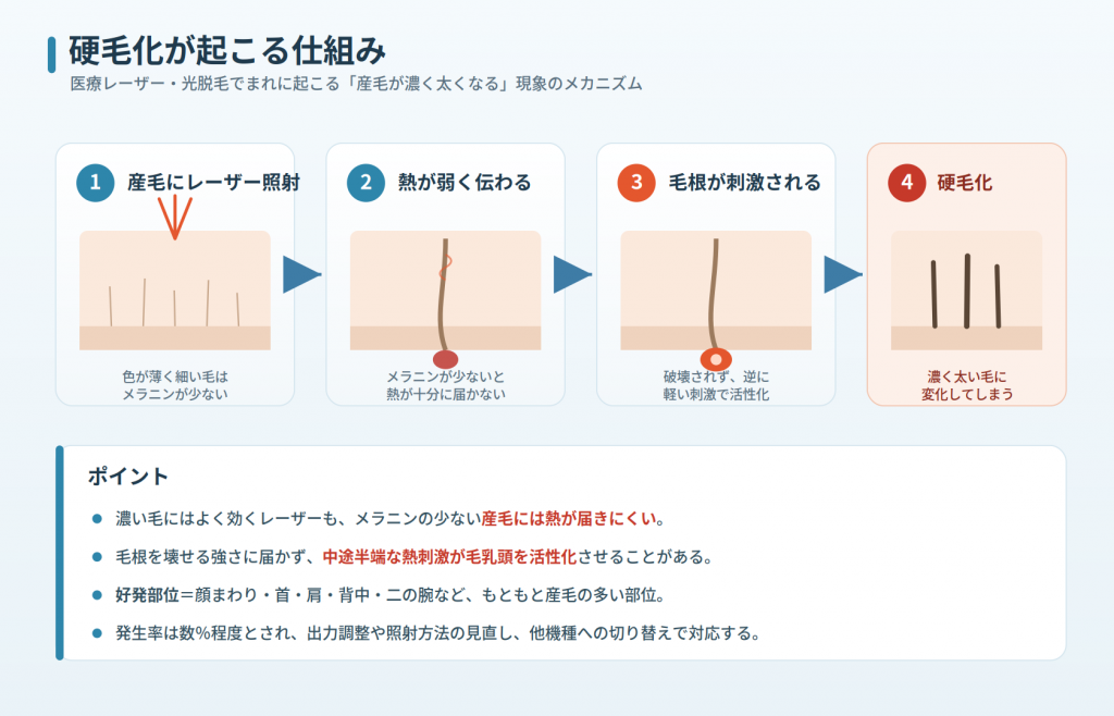 硬毛化の仕組み
